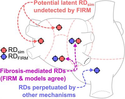 The Fibrotic Substrate in Persistent Atrial Fibrillation Patients: Comparison Between Predictions From Computational Modeling and Measurements From Focal Impulse and Rotor Mapping